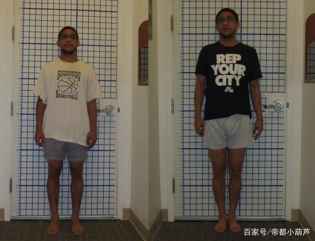 重塑未来身高的科技奇迹，最新增高技术揭秘