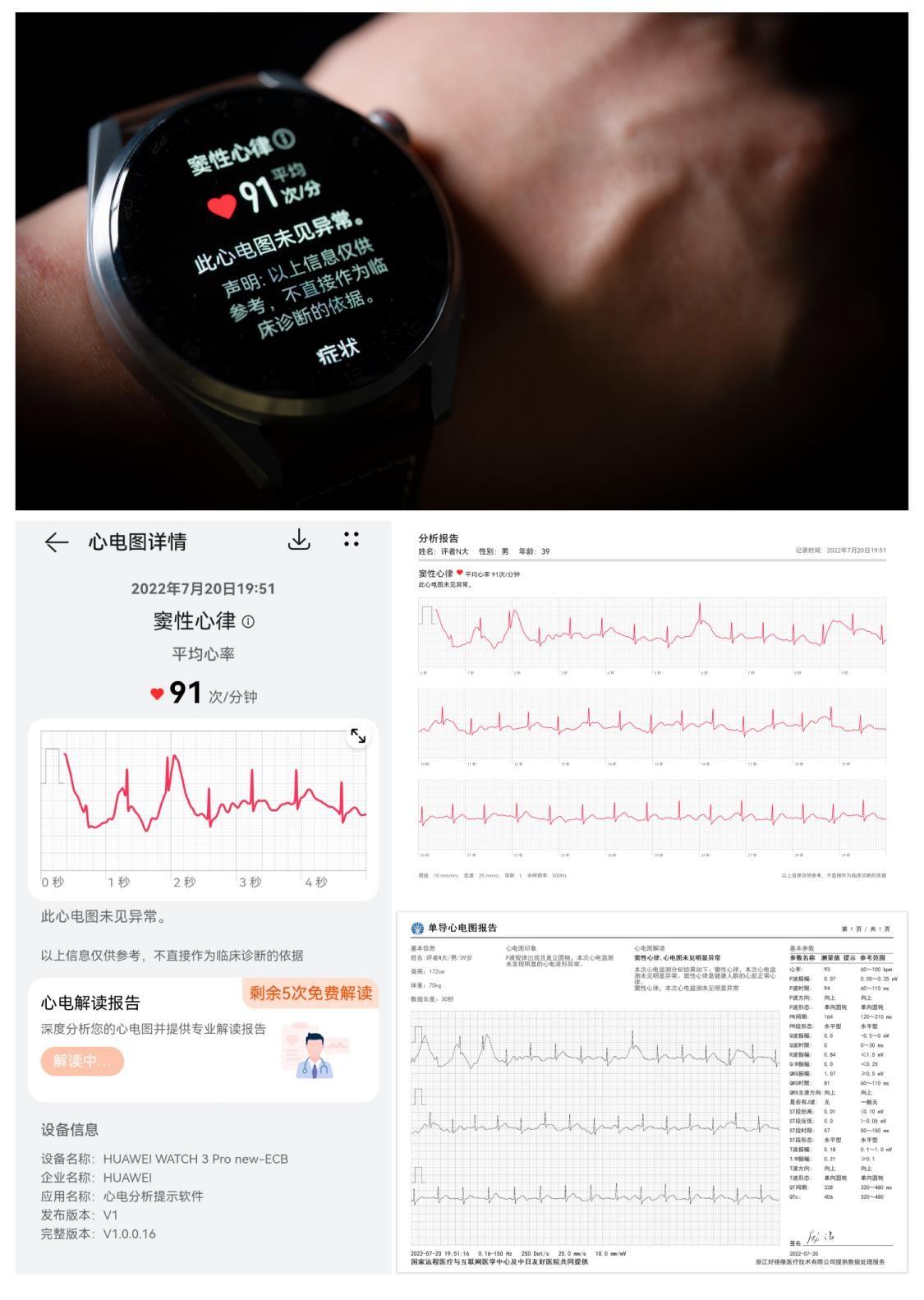 最新款手表，时代印记与科技的完美结合