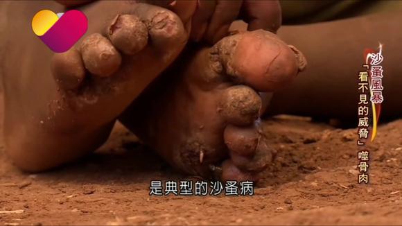 最新沙蚤清理方法与技巧揭秘