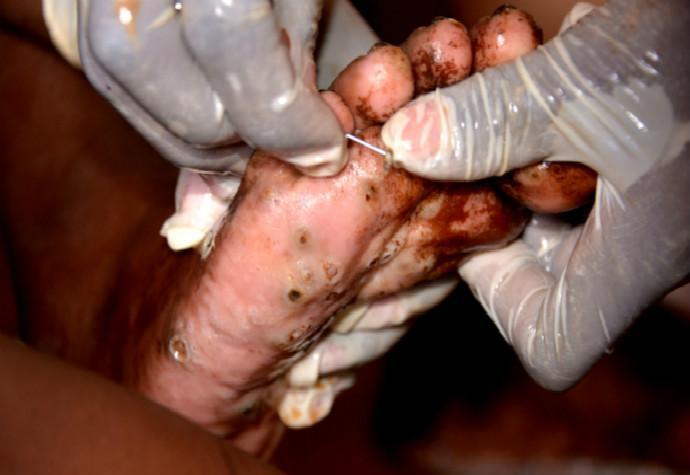 最新沙蚤清理方法与技巧揭秘