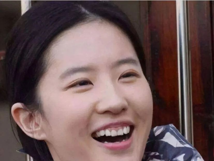 演员假牙安装与佩戴指南,从选择到佩戴的步骤全解析